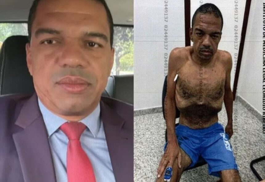 PF suspeita que lobista forjou piora na saúde com greve de fome
