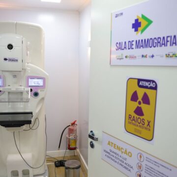 SUS registra aumento de 54,3% em cirurgias mamárias ao longo de uma década