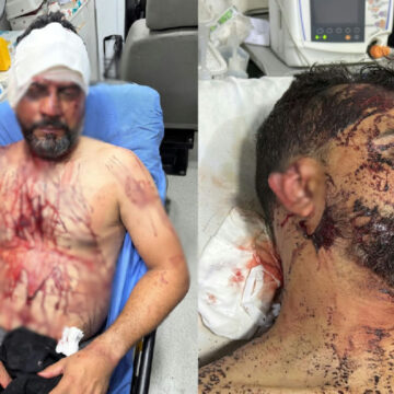 Vereador e família são vítimas de tortura e roubo em residência de Rondonópolis Vereador e família são vítimas de tortura e roubo em residência de Rondonópolis
