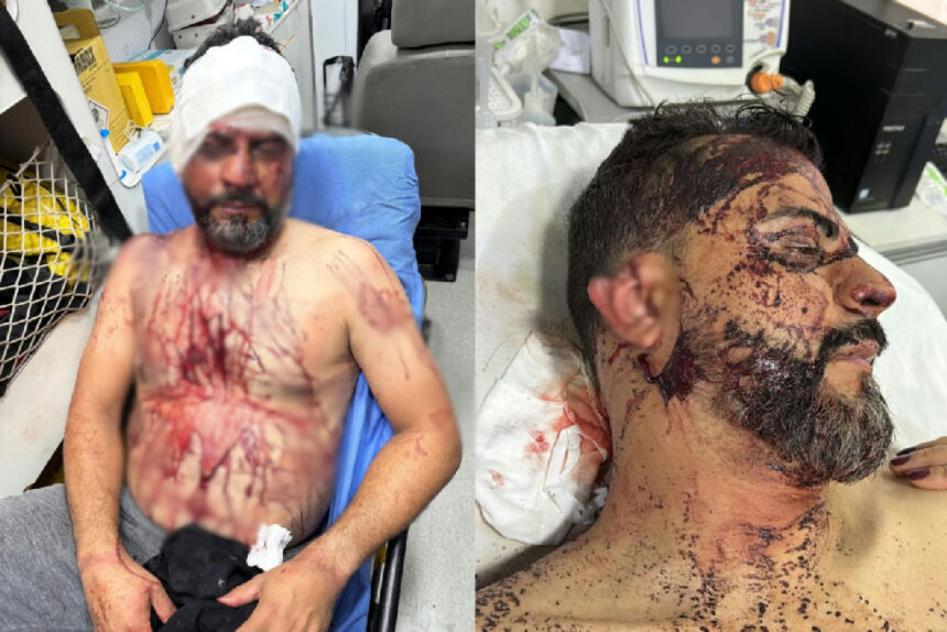 Vereador e família são vítimas de tortura e roubo em residência de Rondonópolis Vereador e família são vítimas de tortura e roubo em residência de Rondonópolis